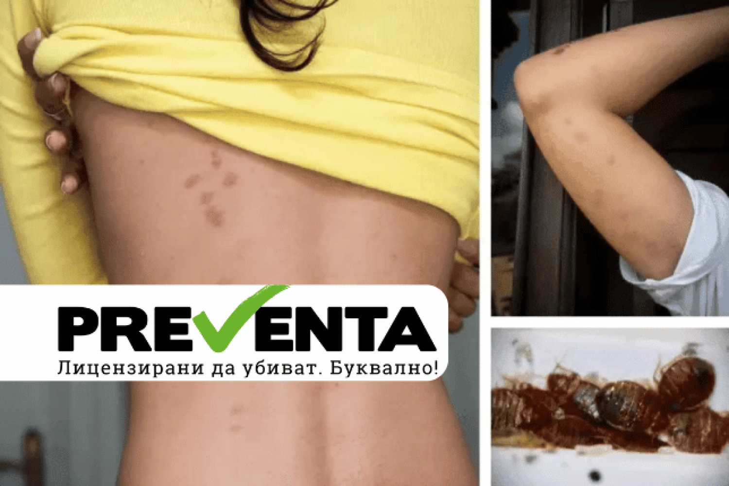 Как да се лекуваме от ухапване от дървеници: Ефективни методи и съвети